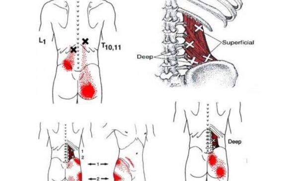 Low Back Trigger Points