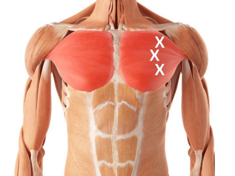 Pectoralis Trigger Points | How To Find And Release