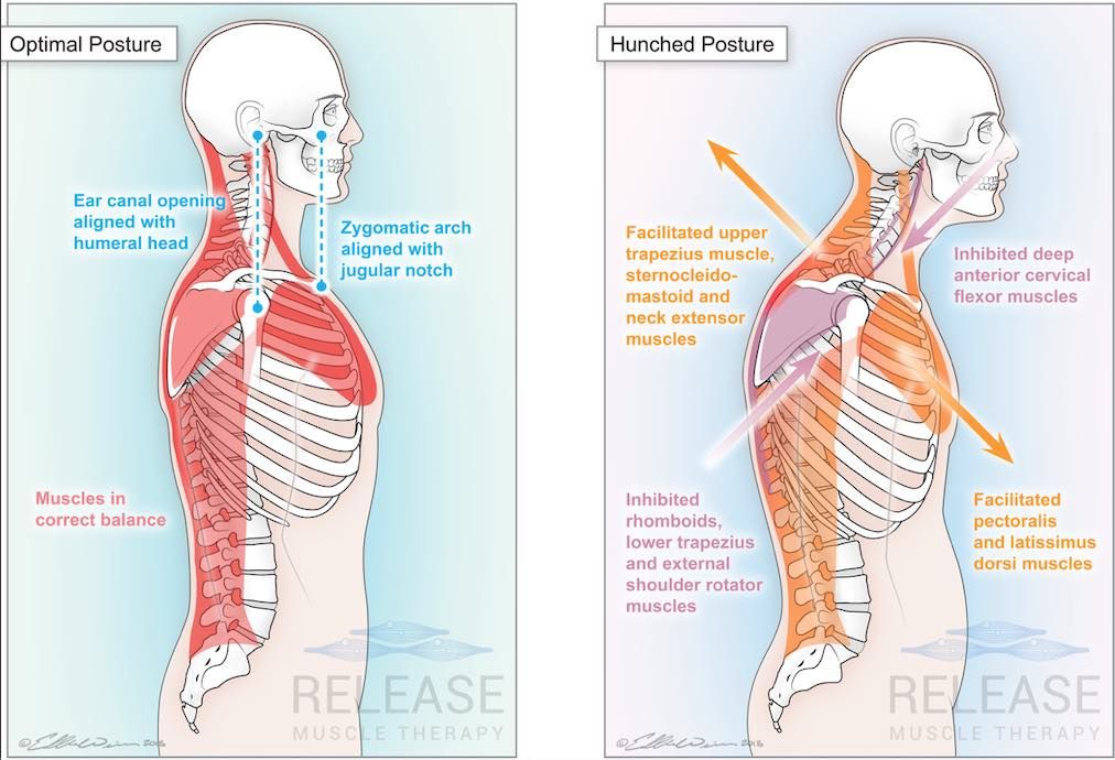 What is Neuromuscular Therapy?