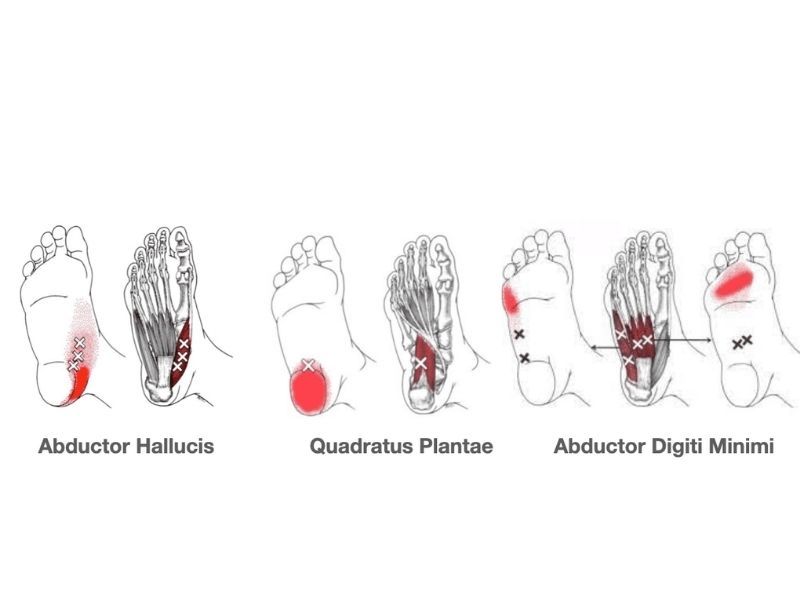 Self-Massage Techniques for Trigger Points in Your Feet