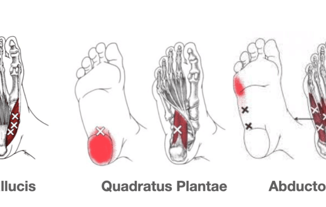 Trigger points in feet
