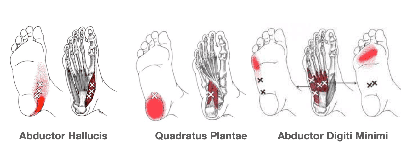 Trigger points in feet