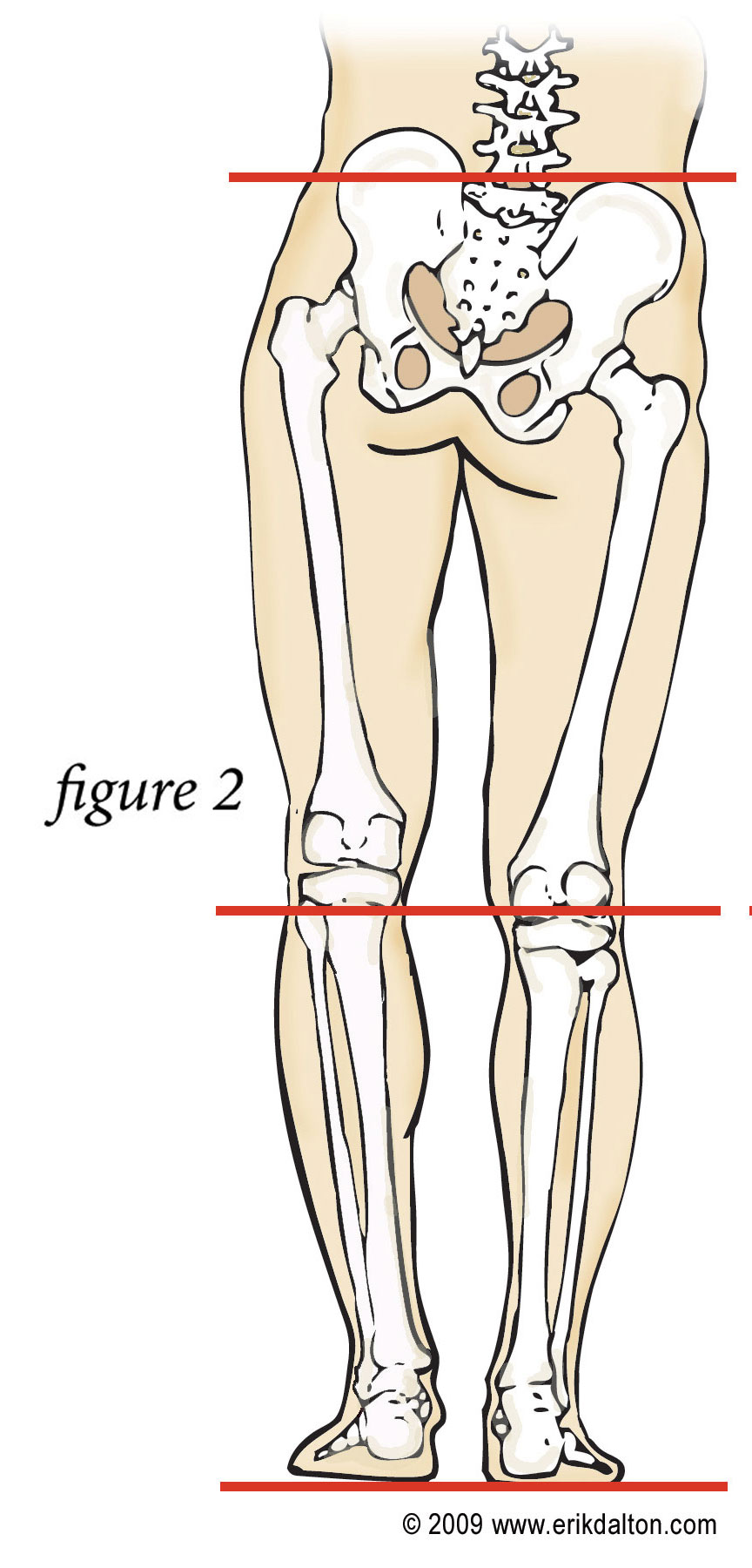 Is A Short-leg Contributing To Your Sacroiliac Joint Pain?