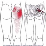 Piriformis Trigger Points | How To Find And Self Treat