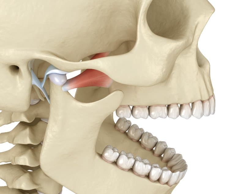 Pterygoid-Lateral
