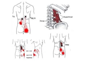 Quadratus Lumborum Archives - Release Muscle Therapy